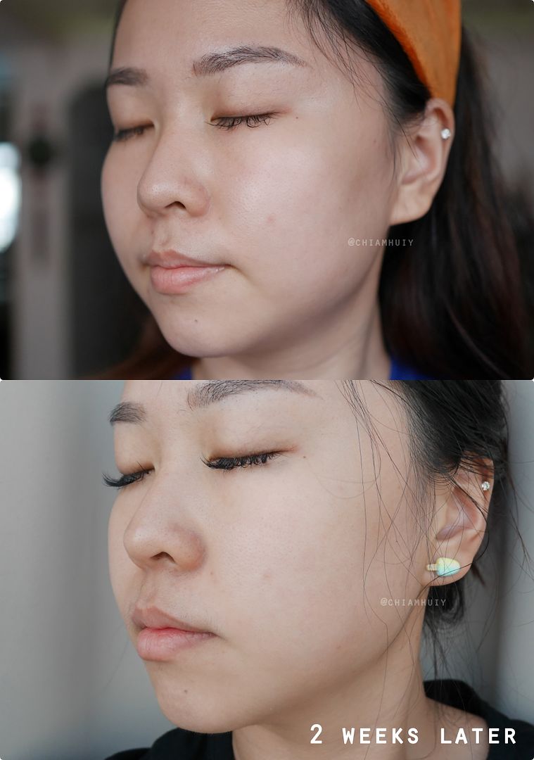 photo SK-II before and after.jpg
