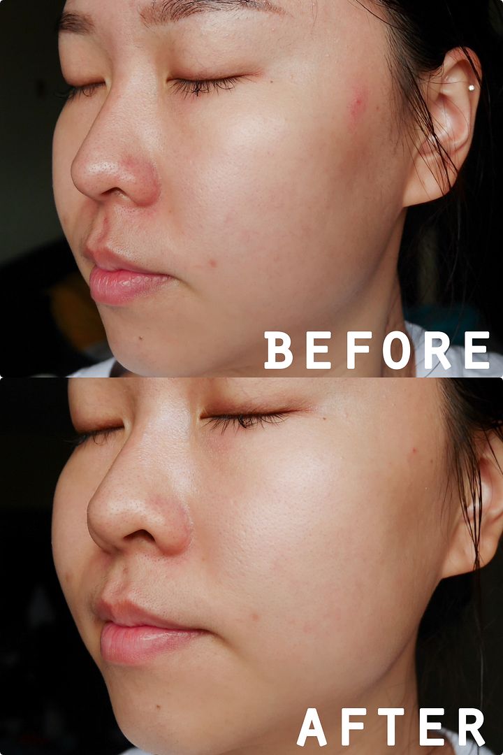 photo Sand amp Sky Flash Perfection Exfoliating Treatment before and after.jpg